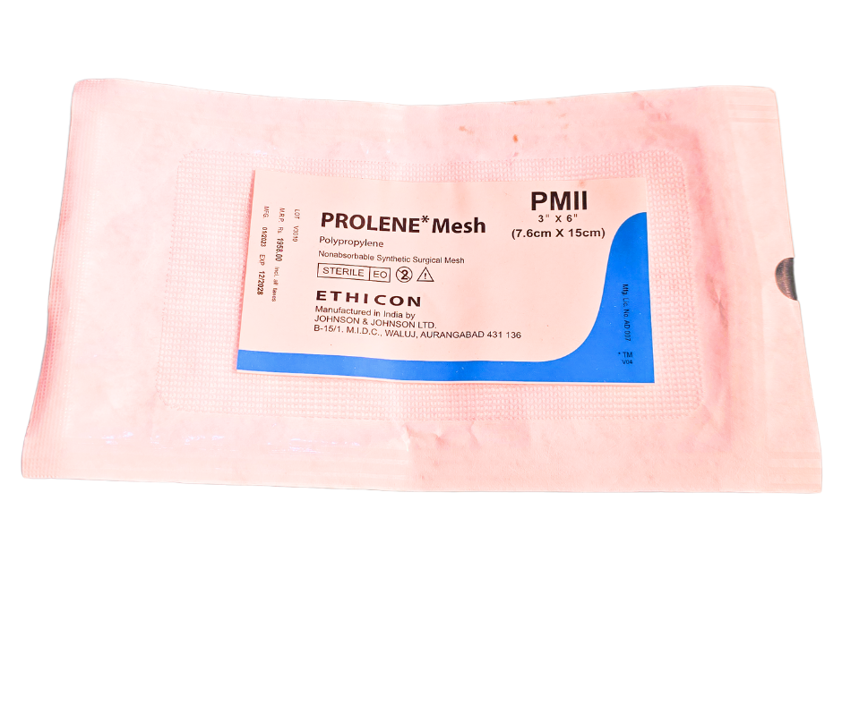 Prolene mesh